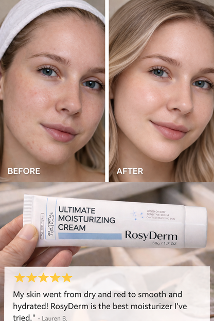 RosyDerm™ Multi-Action Rejuvenating Cream – Deep Hydration & Skin Repair