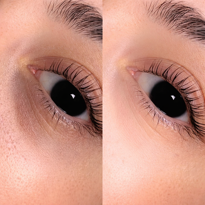 EyeRevive™ Collagen Hydrogel Eye Patches – Reduce Dark Circles & Puffiness