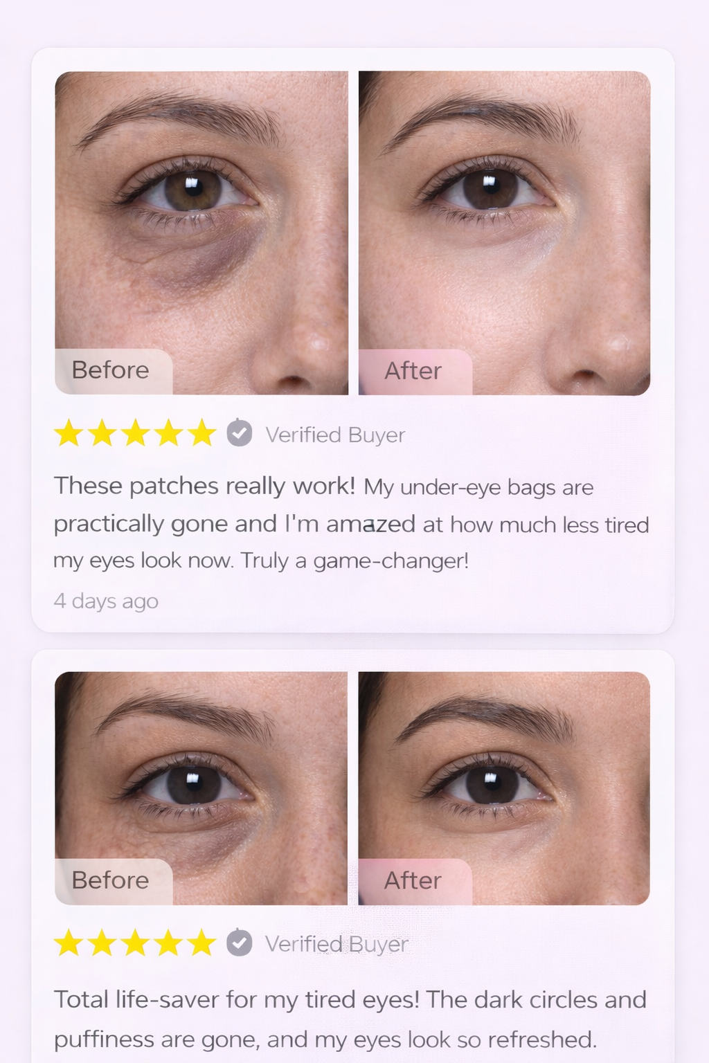 EyeRevive™ Collagen Hydrogel Eye Patches – Reduce Dark Circles & Puffiness
