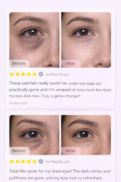 EyeRevive™ Collagen Hydrogel Eye Patches – Reduce Dark Circles & Puffiness