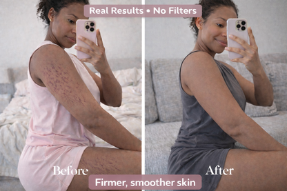 DermaSmooth™ Heat Sculpt Cream – Stretch Mark & Firming Body Treatment (300g)