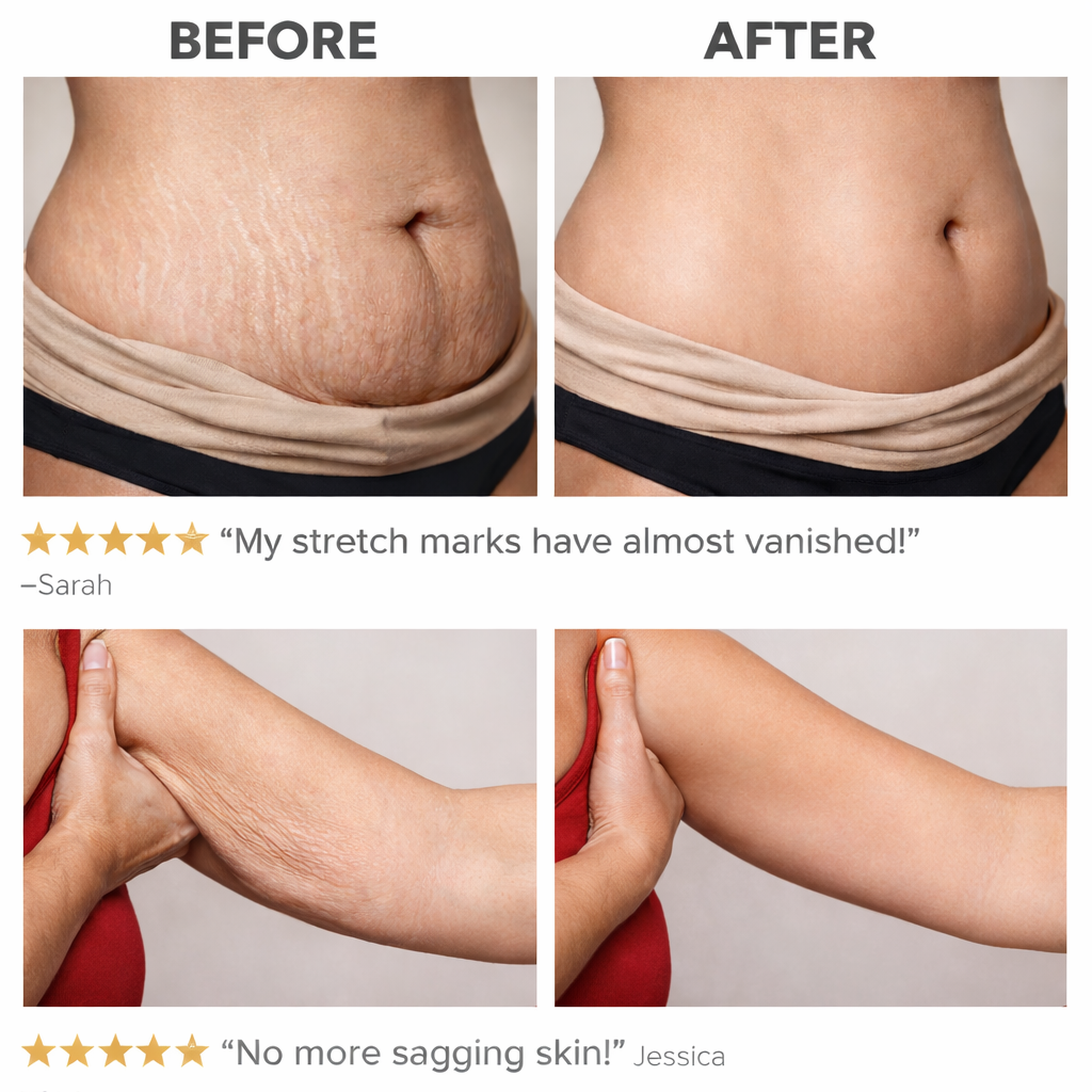 DermaSmooth™ Heat Sculpt Cream – Stretch Mark & Firming Body Treatment (300g)