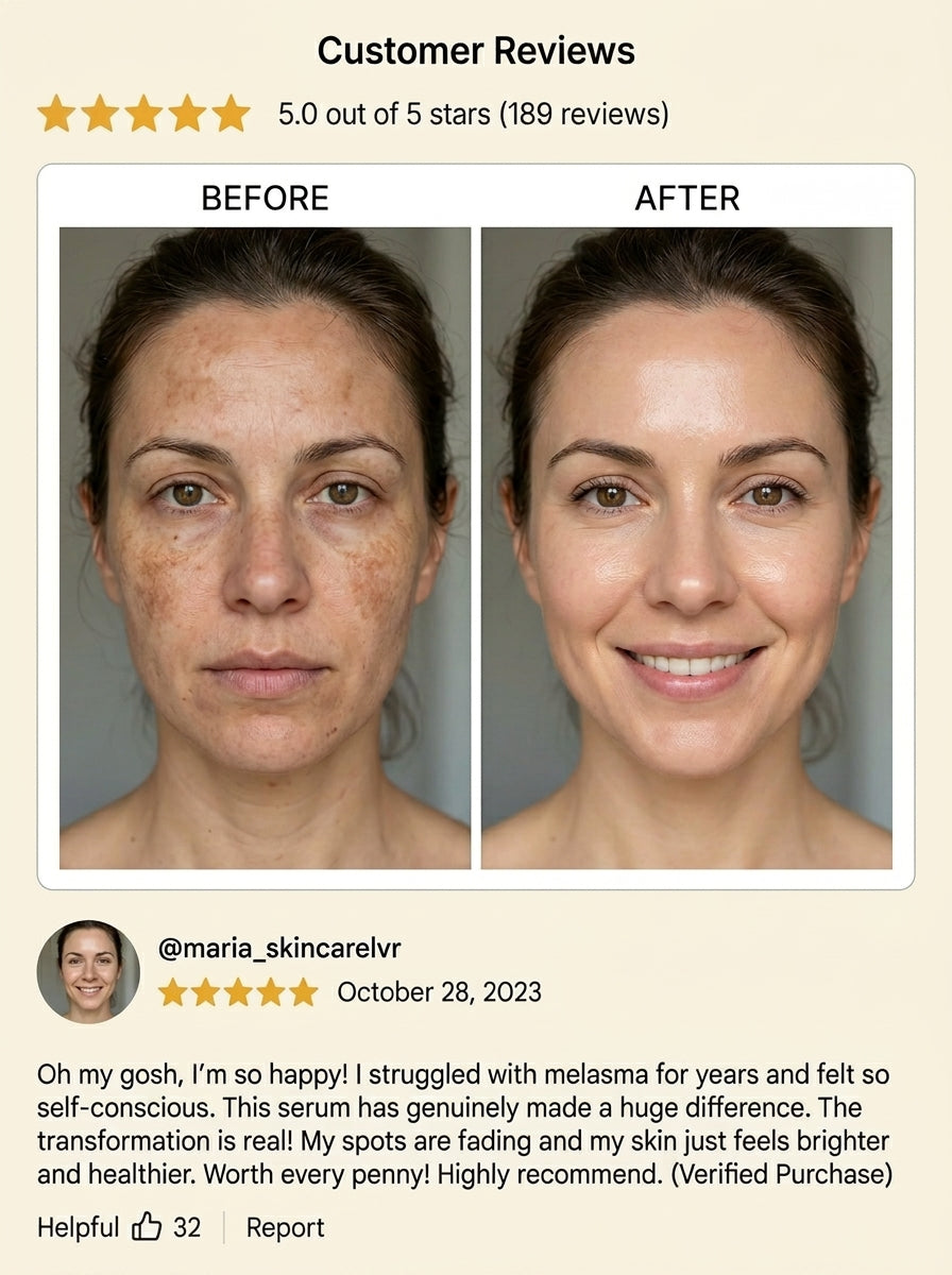 RosyDerm™ Multi-Action Rejuvenating Cream – Deep Hydration & Skin Repair