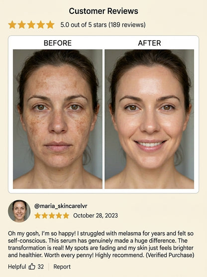 RosyDerm™ Multi-Action Rejuvenating Cream – Deep Hydration & Skin Repair